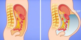 როდის არის ღვიძლი საფრთხის წინაშე? როგორ უნდა მივხდეთ, რომ ღვიძლს ყურადღება სჭირდება?