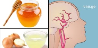 გაიწმინდეთ თავის ტვინის სისხლძარღვები ამ ნაცადი და ძალიან ეფექტური მეთოდებით