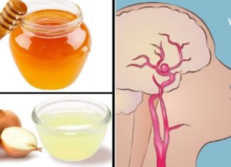 გაიწმინდეთ თავის ტვინის სისხლძარღვები ამ ნაცადი და ძალიან ეფექტური მეთოდებით