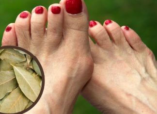 თუ ტერფის დეფორმაცია გაქვთ და მისი მარტივი გზით მკურნალობა გსურთ, გაეცანით ამ რეცეპტს!