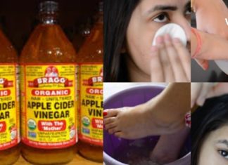 ძმრის 6 სასარგებლო თვისება, რომელიც ყველას გამოადგება! ეს საინტერესოა!