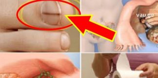 ფრთხილად! 10 ნიშანი, რომელიც არცერთმა ქალმა არ უნდა დააიგნოროს!