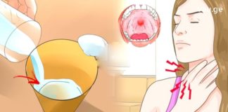 Მარტივი და სწრაფი რეცეპტი ანგინას განკურნავს 4 საათში