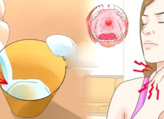 Მარტივი და სწრაფი რეცეპტი ანგინას განკურნავს 4 საათში