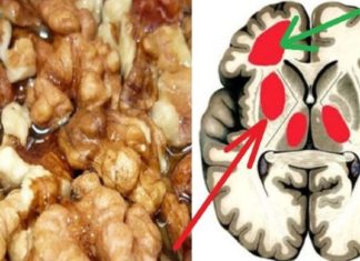 ტვინის სისხლძარღვების გაწმენდის 5 უნიკალური მეთოდი, რომელთა შესახებ ექიმები დუმან…!