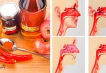 აი რას აკეთებს ვაშლის ძმარი ინფექციების წინააღმდეგ! საჭირო ინფორმაციააა…