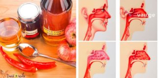 აი რას აკეთებს ვაშლის ძმარი ინფექციების წინააღმდეგ! საჭირო ინფორმაციააა…