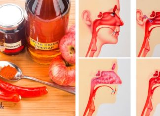 აი რას აკეთებს ვაშლის ძმარი ინფექციების წინააღმდეგ! საჭირო ინფორმაციააა…