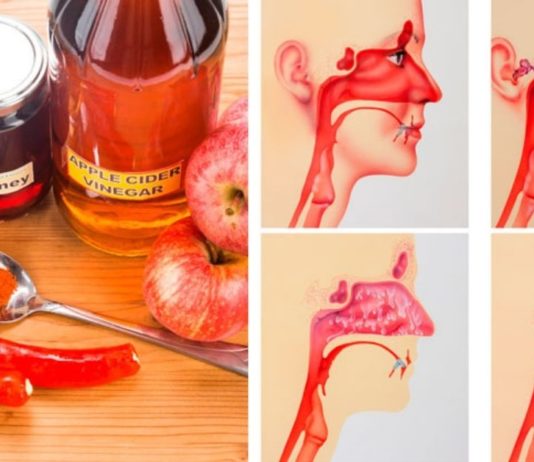 აი რას აკეთებს ვაშლის ძმარი ინფექციების წინააღმდეგ! საჭირო ინფორმაციააა…