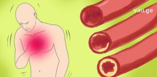 როგორ აღვადგინოთ სისხლძარღვების ფუნქციონირება? ხალხური საშუალებები, რომლებიც ფეხზე დაგაყენებთ