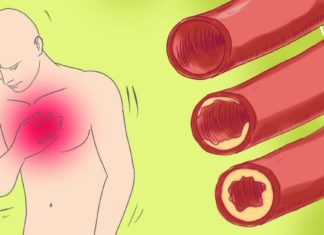 როგორ აღვადგინოთ სისხლძარღვების ფუნქციონირება? ხალხური საშუალებები, რომლებიც ფეხზე დაგაყენებთ