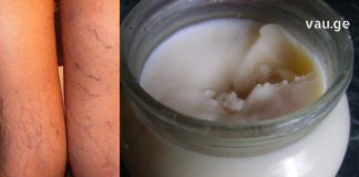 ვარიკოზი არასდროს შეგაწუხებთ, 50 წელს რომ გადაცდებით მაშინაც კი, თუ ყოველ საღამოს მიიღებთ ამ წამალს.