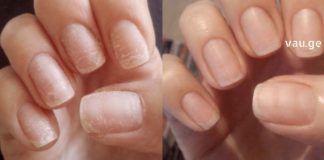 ასე შევძელი ჩემი მტვრევადი და სუსტი ფრჩხილების გამაგრება. უკვე პრიალა და მყარია