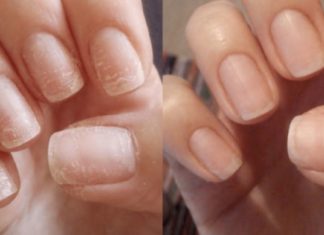 ასე შევძელი ჩემი მტვრევადი და სუსტი ფრჩხილების გამაგრება. უკვე პრიალა და მყარია