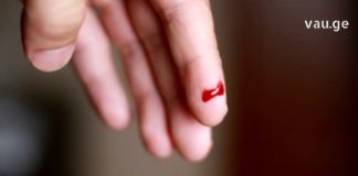 როგორ უნდა შეაჩეროთ სისხლდენა 10 წამში? ეფექტური საშუალება, რომელიც ყველა თქვენგანის სამზარეულოშია