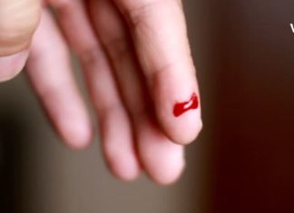 როგორ უნდა შეაჩეროთ სისხლდენა 10 წამში? ეფექტური საშუალება, რომელიც ყველა თქვენგანის სამზარეულოშია