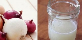 ხახვისა და თეთრი ძმრის კომბინაცია საუკეთესო საშუალებაა მაზოლების წინააღმდეგ