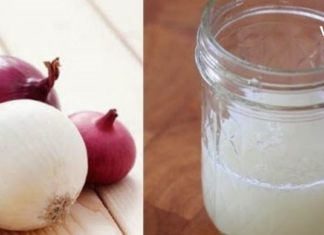 ხახვისა და თეთრი ძმრის კომბინაცია საუკეთესო საშუალებაა მაზოლების წინააღმდეგ