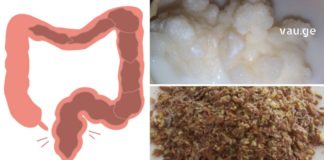 როგორ გავიწმინდოთ ნაწლავები სახლის პირობებში? ყველაზე ეფექტური მეთოდი