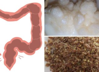 როგორ გავიწმინდოთ ნაწლავები სახლის პირობებში? ყველაზე ეფექტური მეთოდი