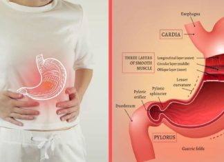 გასტრიტის შემსუბუქება უმარტივესი მეთოდით