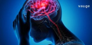 ეს გასაოცარი ნაყენი ამცირებს შიდაქალის წნევას, სისხლის შედედების წარმოქმნას, ხსნის ტაქიკარდიას, არითმიებს