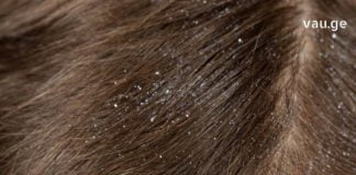 გათავისუფლდით არასასურველი ქერტლისგან ამ მეთოდით