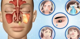 სინუსიტის მკურნალობა სახლის პირობებში ყველაზე ეფექტურად შევძელით მთელმა ოჯახმა – გაგიზიარებთ განმაცვიფრებელ რეცეპტებს