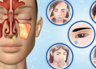 სინუსიტის მკურნალობა სახლის პირობებში ყველაზე ეფექტურად შევძელით მთელმა ოჯახმა – გაგიზიარებთ განმაცვიფრებელ რეცეპტებს