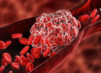 ნატურალური პროდუქტები, რომლებიც სისხლს ათხელებს – ისინი ახდენენ სისხლის შედედების პრევენციას