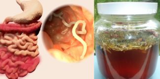 ჭიები გაწუხებთ და აღარ იცით როგორ დააღწიოთ თავი? მაშინ ეს სტატია თქვენთვისაა – შეიტყვეთ უნიკალური წამლის შესახებ