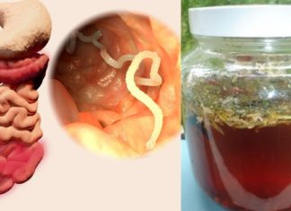 ჭიები გაწუხებთ და აღარ იცით როგორ დააღწიოთ თავი? მაშინ ეს სტატია თქვენთვისაა – შეიტყვეთ უნიკალური წამლის შესახებ