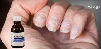 ხშირად მიწევს ბოსტანში მუშაობა და ამის გამო ფრჩხილები ძალიან დამიზიანდა. აღმოვაჩინე რამდენიმე ძალიან ეფექტური მეთოდი