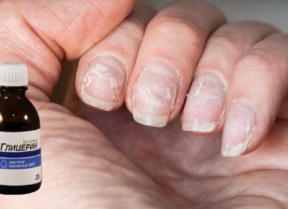 ხშირად მიწევს ბოსტანში მუშაობა და ამის გამო ფრჩხილები ძალიან დამიზიანდა. აღმოვაჩინე რამდენიმე ძალიან ეფექტური მეთოდი