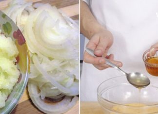 ხალხური მედიცინა სკლეროზსაც შველის, თან საკმაოდ ეფექტურად!