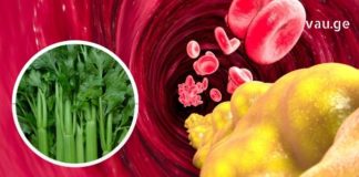 Რატომ იკეტება არტერიები და რა სასმელები ეხმარება მათ გაწმენდას