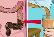 დროა გაიწმინდოთ ორგანიზმი მავნე ქიმიკატებისგან. გთავაზობთ ეფექტურ რეცეპტებს