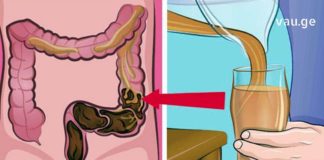 დროა გაიწმინდოთ ორგანიზმი მავნე ქიმიკატებისგან. გთავაზობთ ეფექტურ რეცეპტებს