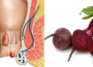 ვისაც ბუასილი აწუხებს, კარგად იცის ამ ტანჯვის შესახებ. ჩვენ გთავაზობთ უსწრაფეს მეთოდს