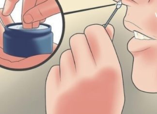 Მალამო ჰაიმორიტის სამკურნალოდ – ძალიან ეფექტურია, მაგრამ გახსოვდეთ, სანამ გამოიყენებთ, ცხვირი მარილიანი ხსნარით ჩამოირეცხეთ