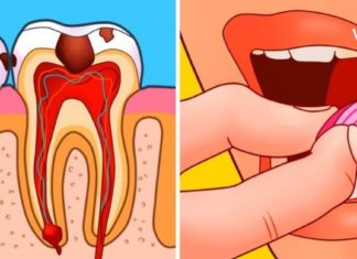 როგორ დავიცხროთ კბილის მტანჯველი ტკივილი სახლის პირობებში