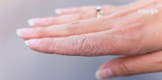 გაუხეშებულ ხელებს ხალხური მედიცინის რეცეპტები დაგირბილებთ. ჩემი ტანჯვა დასრულდა!