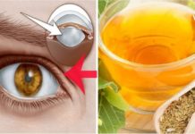 კატარაქტა ჩემი გადაუჭრელი პრობლემა იყო დიდი ხნის განმავლობაში. ერთ მშვენიერ დღესაც ვიპოვე გამოსავალი