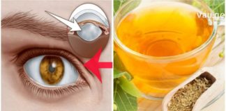 კატარაქტა ჩემი გადაუჭრელი პრობლემა იყო დიდი ხნის განმავლობაში. ერთ მშვენიერ დღესაც ვიპოვე გამოსავალი