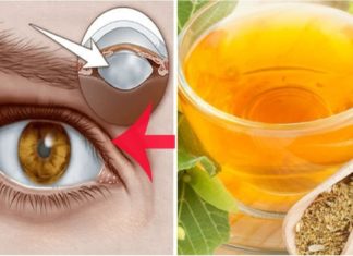 კატარაქტა ჩემი გადაუჭრელი პრობლემა იყო დიდი ხნის განმავლობაში. ერთ მშვენიერ დღესაც ვიპოვე გამოსავალი