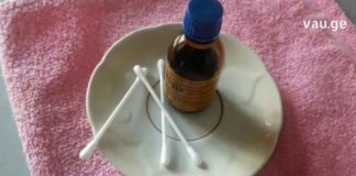 თქვენ შეგიძლიათ დაითვალოთ მინიმუმ 20 სხვადასხვა დაავადება, რასაც იოდის ბადეები ამსუბუქებს