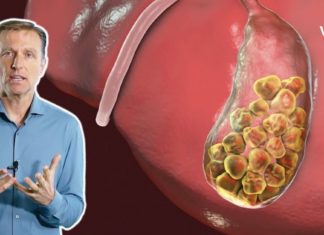 როგორ უნდა გაატაროთ მთელი ცხოვრება ისე, რომ არ შეგაწუხოთ ნაღველში კენჭებმა?!