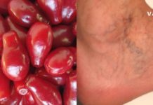 როგორ შეუძლია შინდს გიხსნათ ვარიკოზული ვენების, ფეხების შეშუპების და სხვა დაავადებებისგან? გაიგეთ ამ სტატიაში