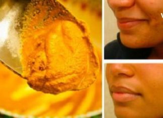 დაიღალეთ აკნესთან ბრძოლით? იცოდით რომ კურკუმა არის ძალიან ეფექტური აკნეს სამკურნალო საშუალება?