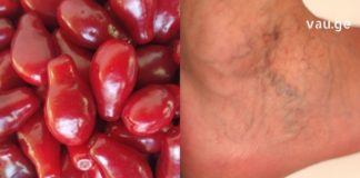 როგორ შეუძლია შინდს გიხსნათ ვარიკოზული ვენების, ფეხების შეშუპების და სხვა დაავადებებისგან? გაიგეთ ამ სტატიაში